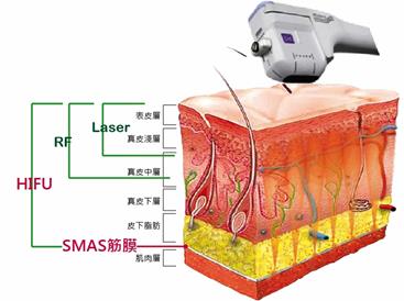 魔提電音波拉提